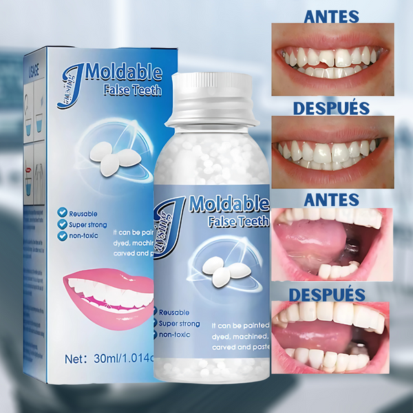 DentiFix: Resina en Esferas para Reparación Temporal de Dientes